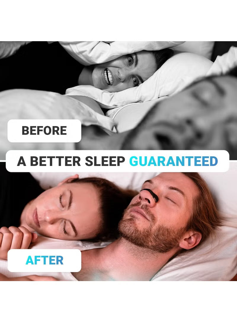 Anti-snoring nose patch ( لاصقة أنف مضادة للشخير )